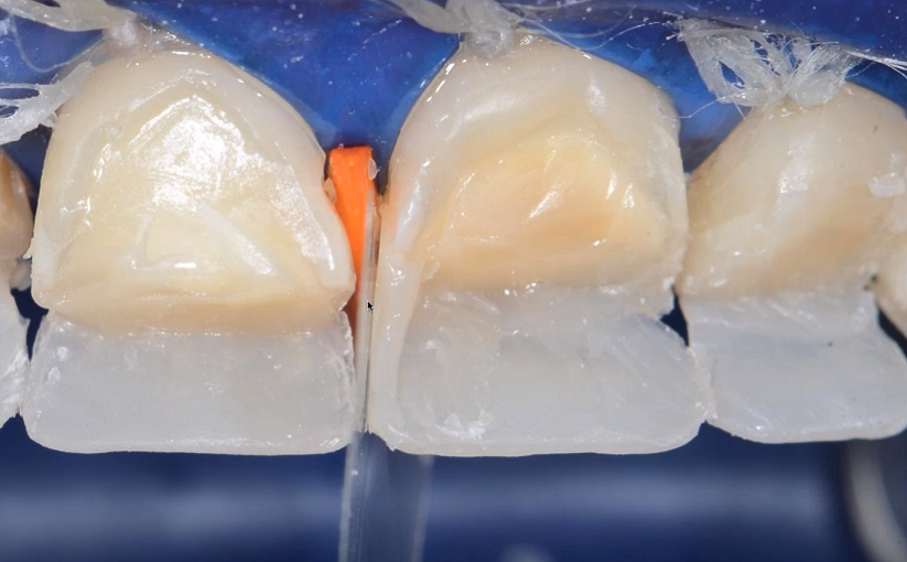 Efficient Solutions With The Modern Composite