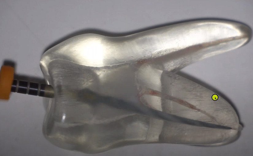 he Motorised Evolution with Hyflex Files