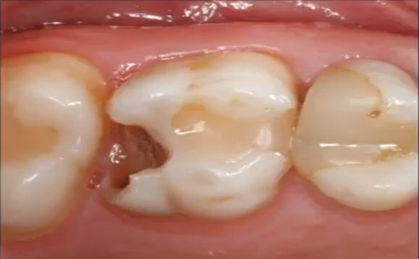Biological-Treatment-of-Teeth