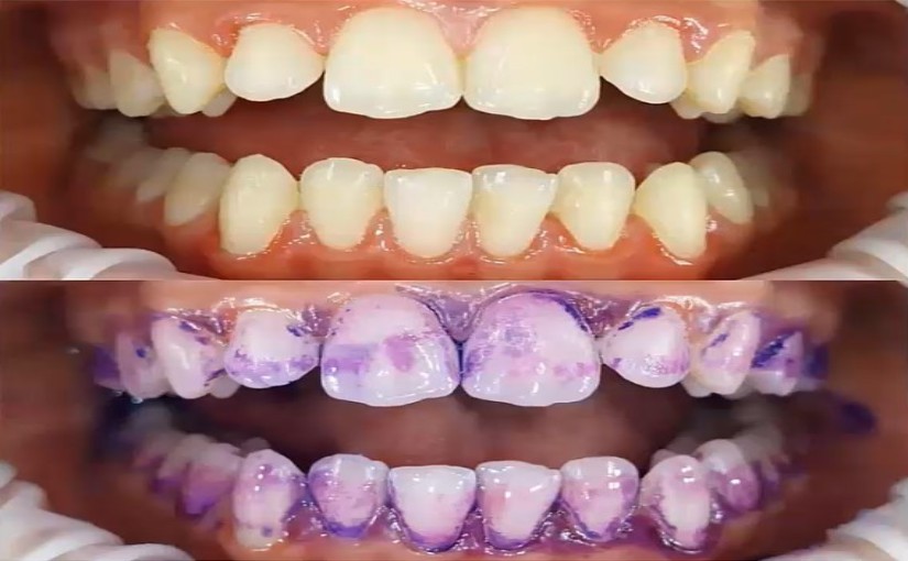 Maximise your profitabilty with GBT