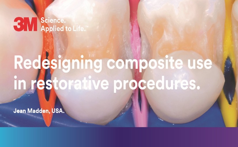 Redesigning Composite Redesigning Composite