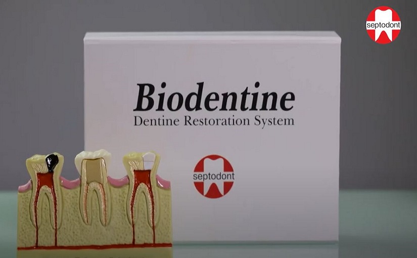 Biodentine Mixing Instructions Dental Education Hub