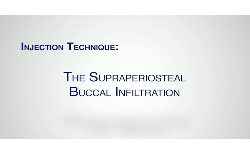 The Supraperiosteal Buccal Infiltration | Wand STA System