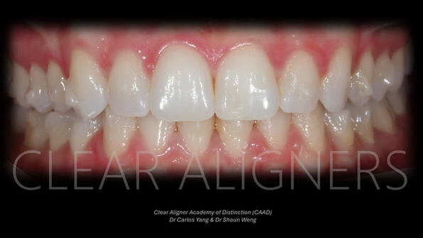 AUCKLAND – Essential Aligner Mastery Course – MAY 2026